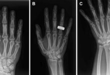 Astronautas realizando radiografías en el espacio