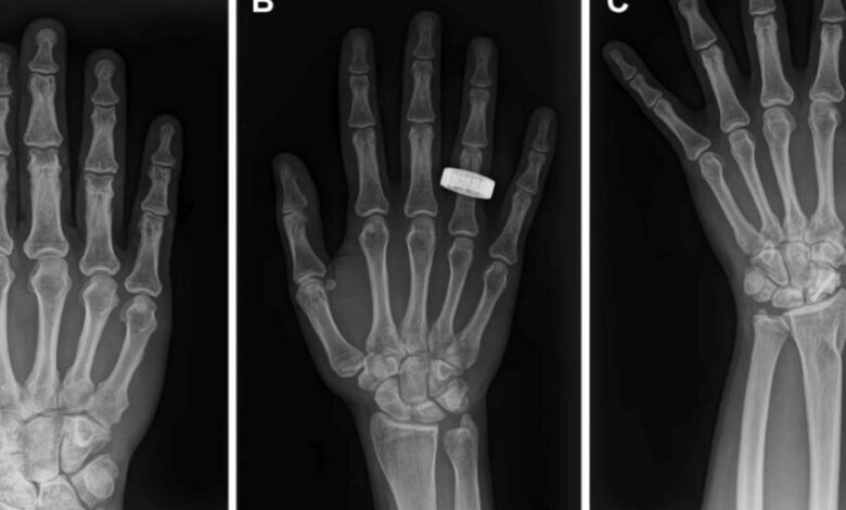 Astronautas realizando radiografías en el espacio