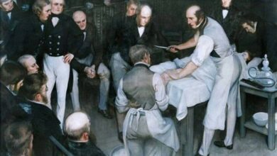 Robert Liston, cirujano escocés, anestesia, cirugía moderna