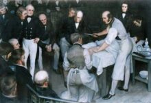 Robert Liston, cirujano escocés, amputando una pierna en solo dos minutos y medio