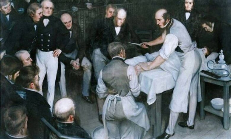 Robert Liston, cirujano escocés, amputando una pierna en solo dos minutos y medio