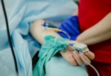 Laboratorio con microscopio y muestra de tejido pancreático