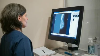 Mujer recibiendo mamografía en la campaña Córdoba Rosa 2026 organizada por APROSS