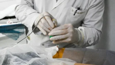 Intervención en osteoma osteoide en una adolescente de 16 años en el Hospital Tránsito Cáceres de Allende